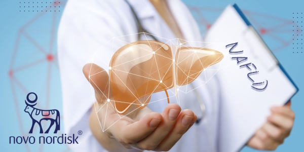 תמונה עבור ״עוברים מהצלחת - לבית המרקחת״, גם הכבד כבר פחות כבד